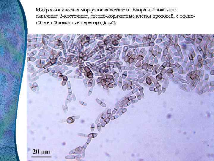 Микроскопическая морфология werneckii Exophiala показаны типичные 2 -клеточные, светло-коричневые клетки дрожжей, с темнопигментированные перегородками,