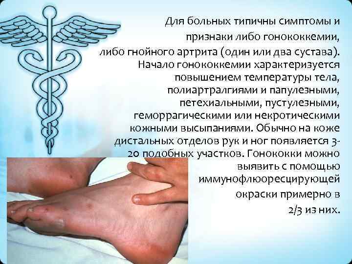 Для больных типичны симптомы и признаки либо гонококкемии, либо гнойного артрита (один или два