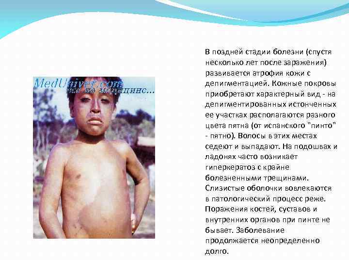 В поздней стадии болезни (спустя несколько лет после заражения) развивается атрофия кожи с депигментацией.