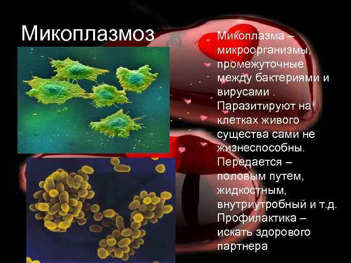 Микоплазмоз Микоплазма – микроорганизмы, промежуточные между бактериями и вирусами. Паразитируют на клетках живого существа