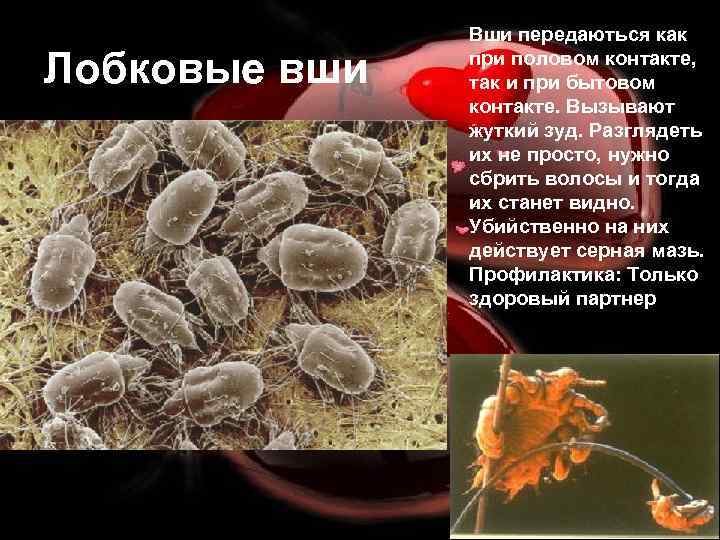 Лобковые вши Вши передаються как при половом контакте, так и при бытовом контакте. Вызывают