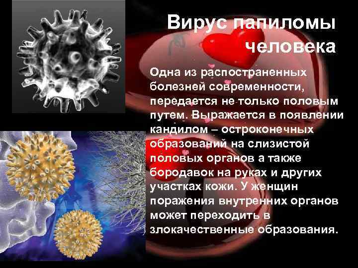 Вирус папиломы человека Одна из распостраненных болезней современности, передается не только половым путем. Выражается