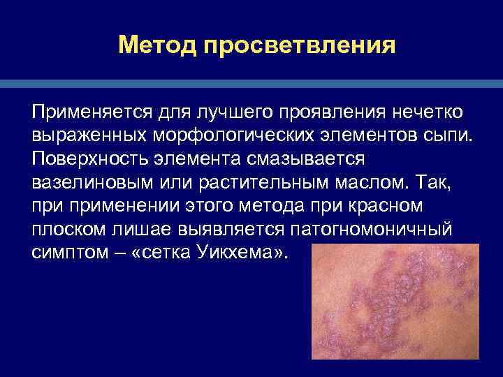 Метод просветвления Применяется для лучшего проявления нечетко выраженных морфологических элементов сыпи. Поверхность элемента смазывается