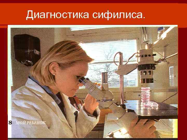 Диагностика сифилиса. 
