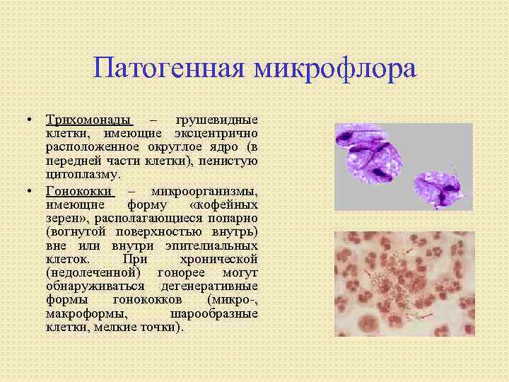 Микроорганизмы женских половых органов. Патогенная форма трихомонады. Остегенная микрофлора.
