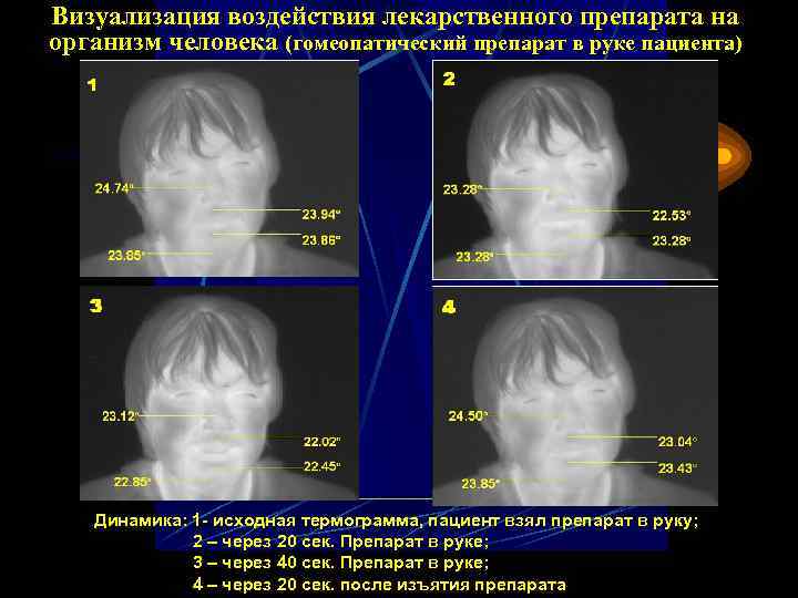Визуализация воздействия лекарственного препарата на организм человека (гомеопатический препарат в руке пациента) Динамика: 1