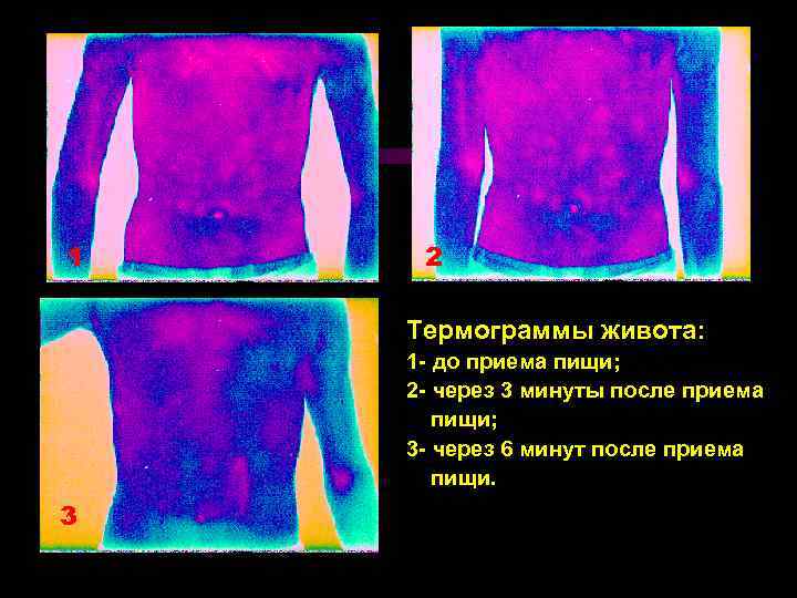 1 2 Термограммы живота: 1 - до приема пищи; 2 - через 3 минуты