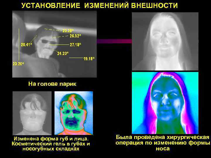 УСТАНОВЛЕНИЕ ИЗМЕНЕНИЙ ВНЕШНОСТИ На голове парик Изменена форма губ и лица. Косметический гель в