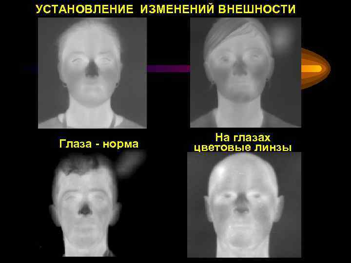 УСТАНОВЛЕНИЕ ИЗМЕНЕНИЙ ВНЕШНОСТИ Глаза - норма На глазах цветовые линзы 