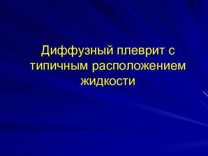 Диффузный плеврит с типичным расположением жидкости 