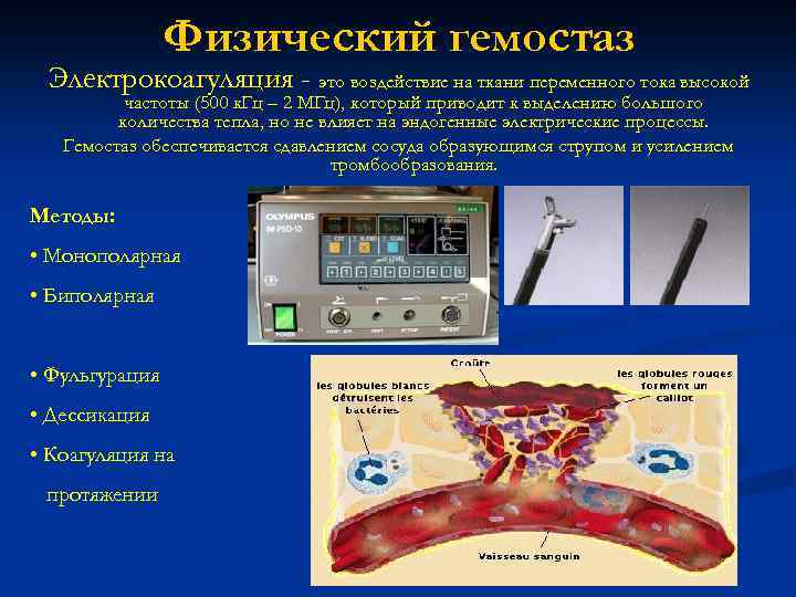 Физический гемостаз Электрокоагуляция - это воздействие на ткани переменного тока высокой частоты (500 к.