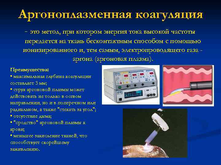 Аргоноплазменная коагуляция - это метод, при котором энергия тока высокой частоты передается на ткань