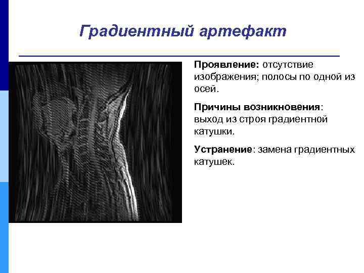 Градиентный артефакт Проявление: отсутствие изображения; полосы по одной из осей. Причины возникновения: выход из