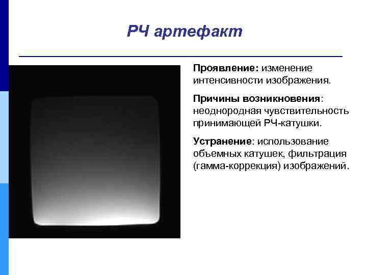 РЧ артефакт Проявление: изменение интенсивности изображения. Причины возникновения: неоднородная чувствительность принимающей РЧ-катушки. Устранение: использование