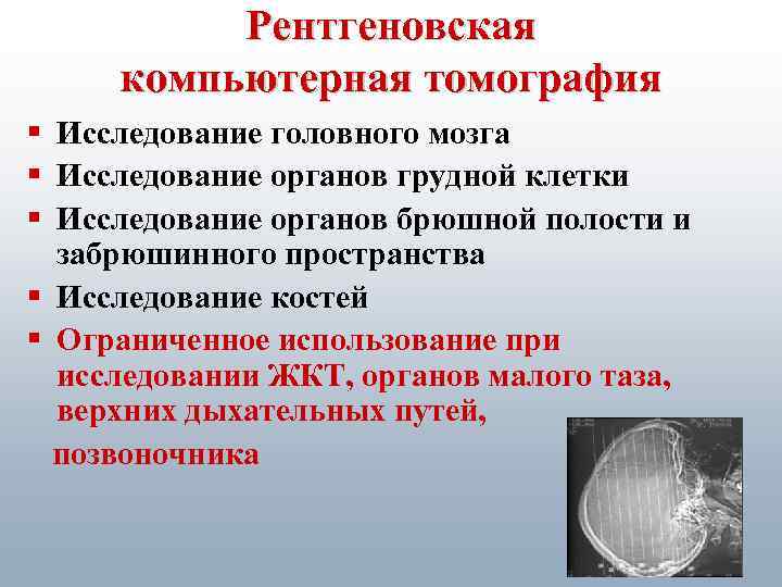 Исследование т. Способы рентгеновского томографического исследования. Функции компьютерной томографии. Рентгеновская томография органов грудной. Метод исследования компьютерная компьютерная томография.