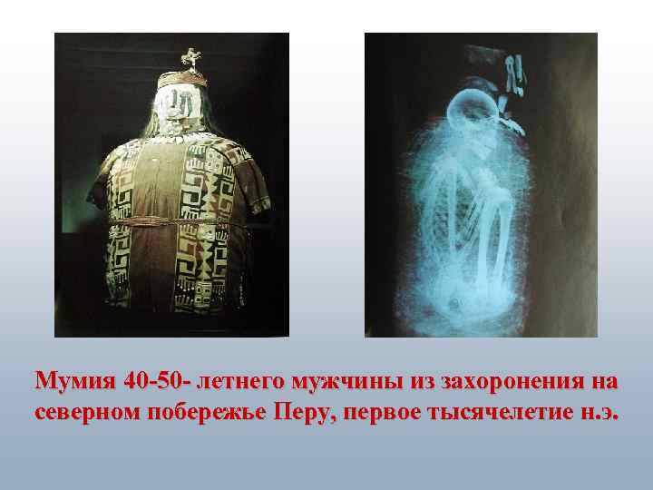 Мумия 40 -50 - летнего мужчины из захоронения на северном побережье Перу, первое тысячелетие