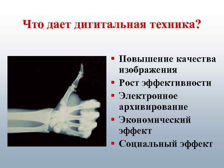 Что дает дигитальная техника? § Повышение качества изображения § Рост эффективности § Электронное архивирование