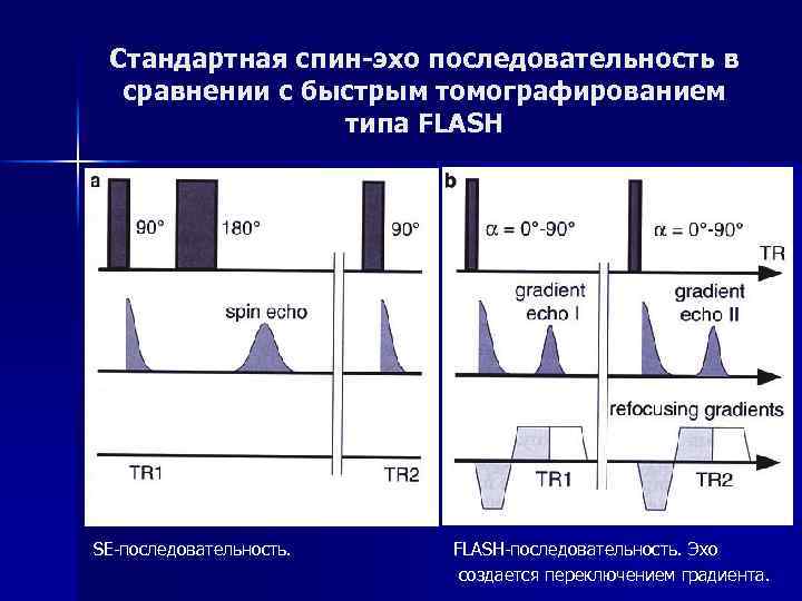 Стандартная спин-эхо последовательность в сравнении с быстрым томографированием типа FLASH SE-последовательность. FLASH-последовательность. Эхо создается