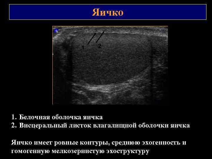 Яичко 1 2 1. Белочная оболочка яичка 2. Висцеральный листок влагалищной оболочки яичка Яичко