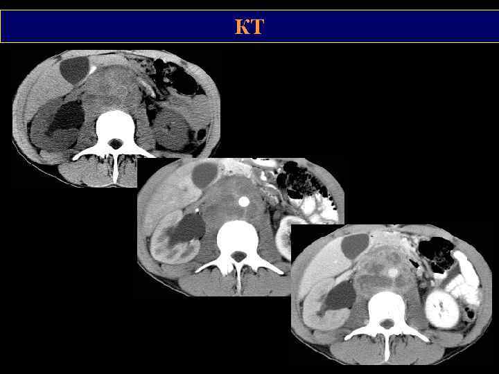 КТ 