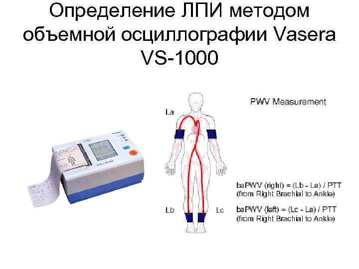 Определение ЛПИ методом объемной осциллографии Vasera VS-1000 