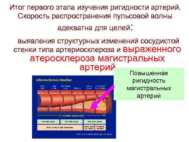 Итог первого этапа изучения ригидности артерий. Скорость распространения пульсовой волны адекватна для целей: выявления