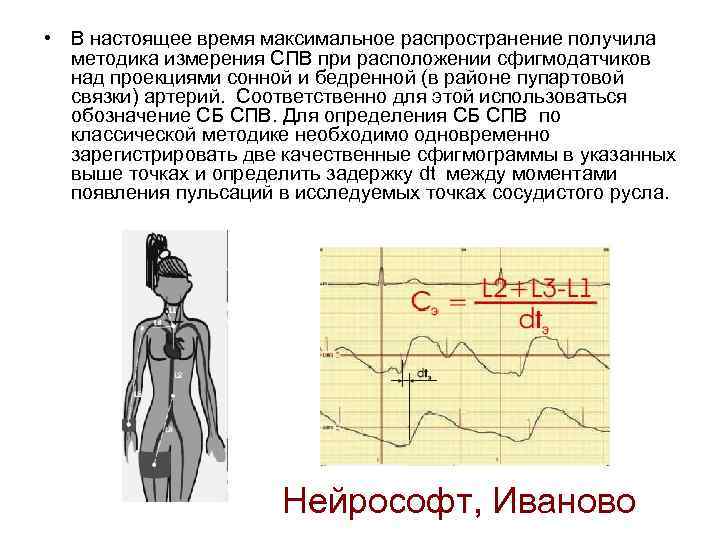  • В настоящее время максимальное распространение получила методика измерения СПВ при расположении сфигмодатчиков