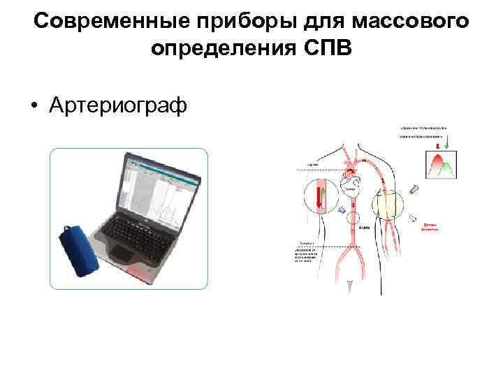 Современные приборы для массового определения СПВ • Артериограф 
