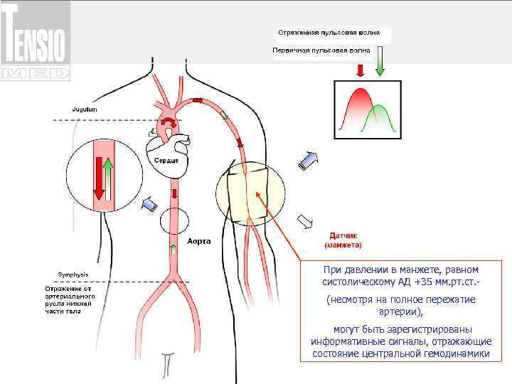 При давлении в манжете, равном систолическому АД +35 мм. рт. ст. (несмотря на полное