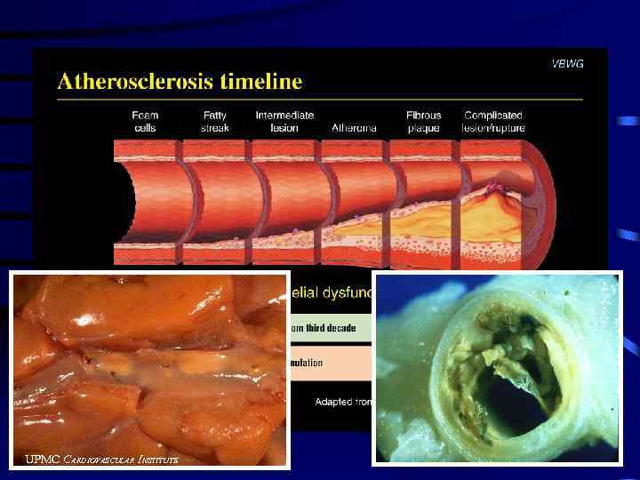 UPMC CARDIOVASCULAR INSTITUTE 