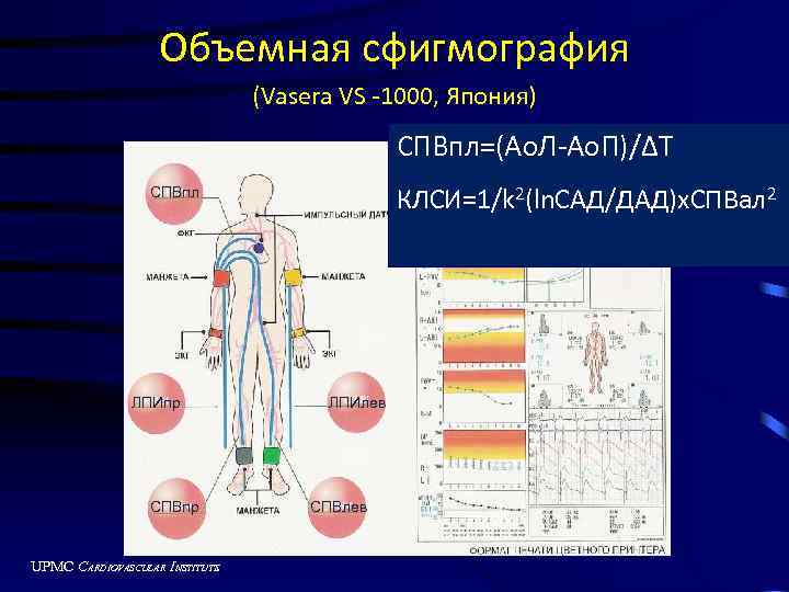 Объемная сфигмография (Vasera VS -1000, Япония) СПВпл=(Ao. Л-Ao. П)/ΔT КЛСИ=1/k 2(ln. САД/ДАД)х. СПВал 2