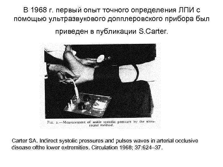 В 1968 г. первый опыт точного определения ЛПИ с помощью ультразвукового допплеровского прибора был