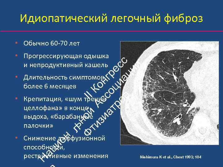 Идиопатический легочный фиброз • Обычно 60‐ 70 лет ьн Ф ой II ти А