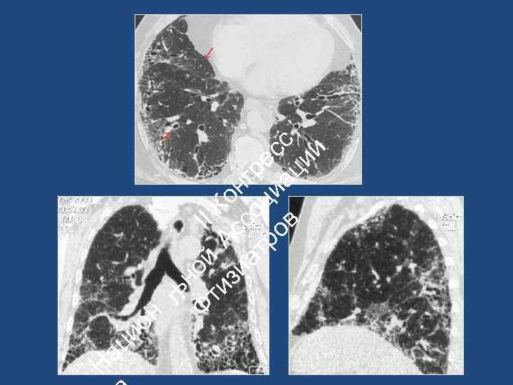 ац ио Н ьн Ф ой II ти А К зи с он ат