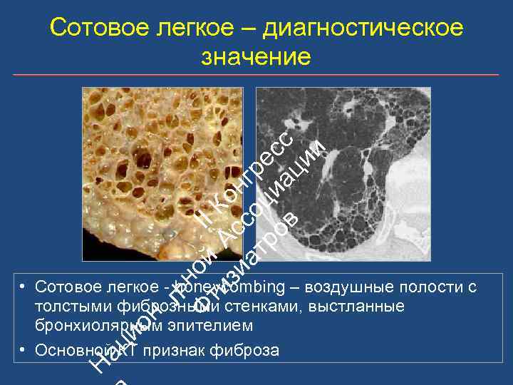 ьн Ф ой II ти А К зи с он ат со гр ро