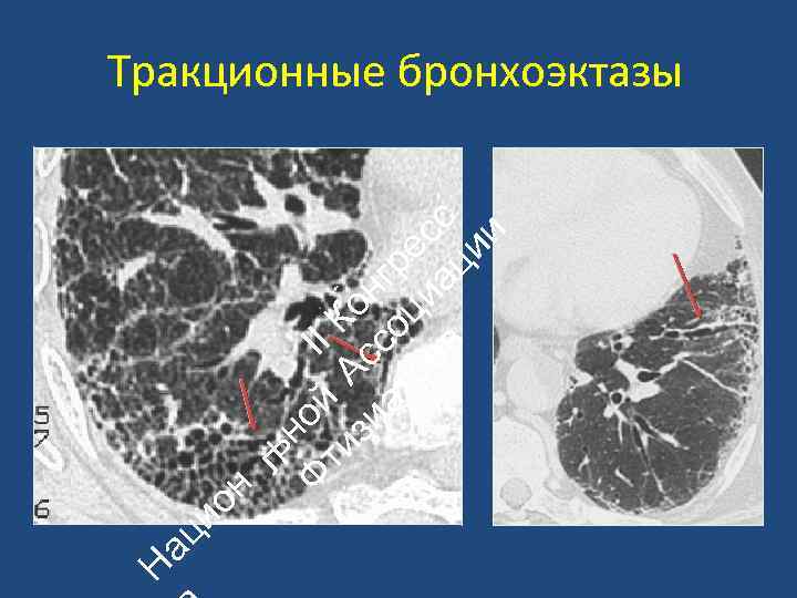 ац ио Н ьн Ф ой II ти А К зи с он ат