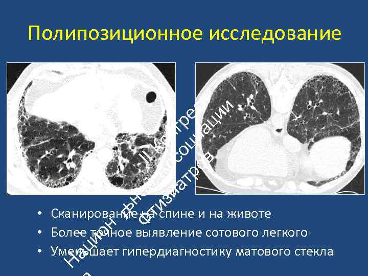 ьн Ф ой II ти А К зи с он ат со гр ро