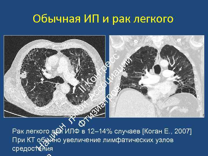 н ьн Ф ой II ти А К зи с он ат со гр
