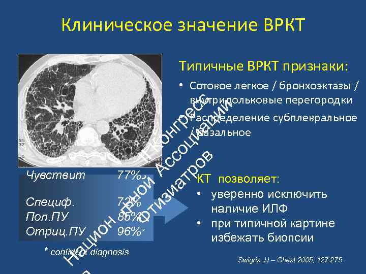 Идиопатический легочный фиброз клинические рекомендации. ВРКТ. ВРКТ это в медицине. ВРКТ паттерны нефиброзирующего ГП.