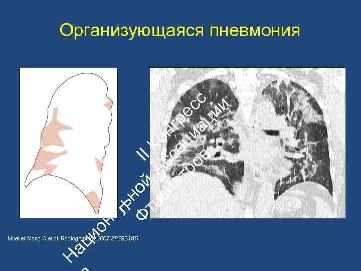 ац ио н ьн Ф ой II ти А К зи с он ат