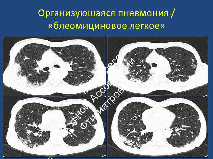 ац ио Н ьн Ф ой II ти А К зи с он ат