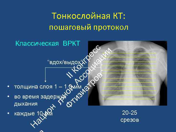 Тонкослойная КТ: пошаговый протокол ьн Ф ой II ти А К зи с он