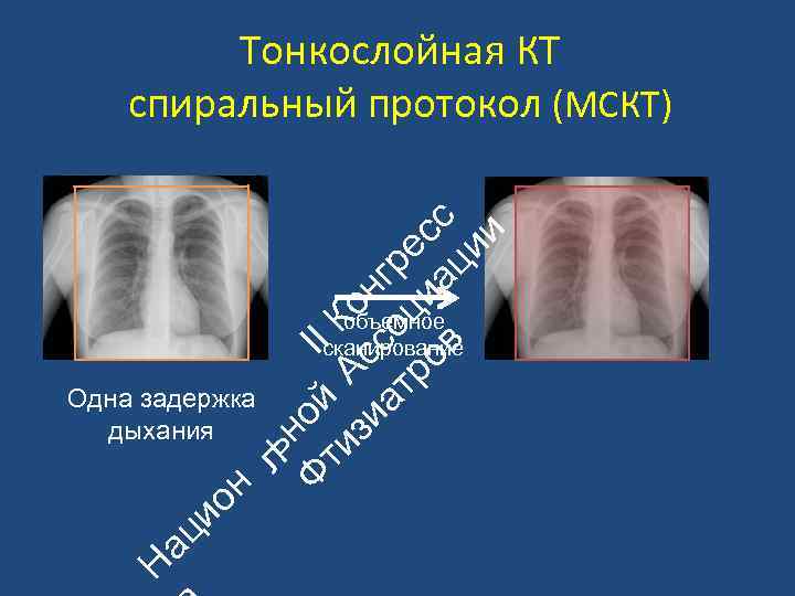 ьн Ф ой II ти А К зи с он ат со гр ро