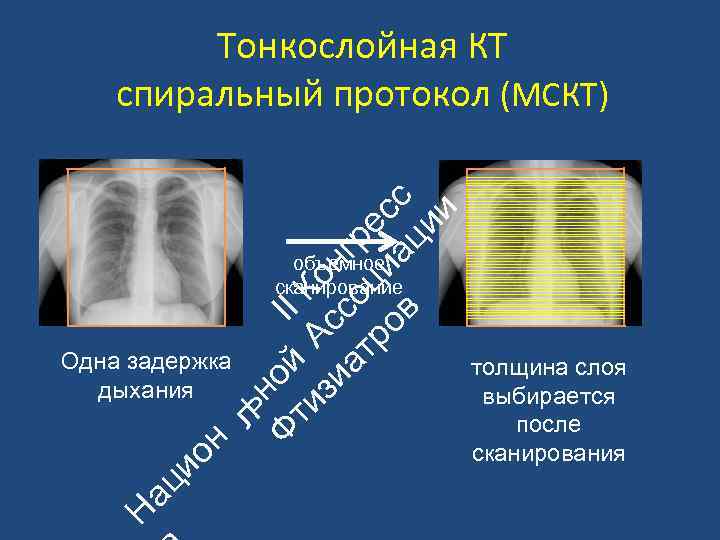 ьн Ф ой II ти А К зи с он ат со гр ро