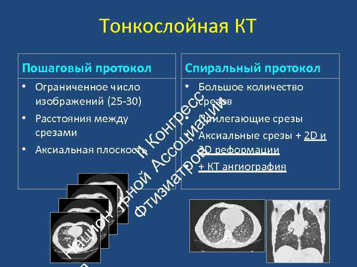 Тонкослойная КТ Спиральный протокол • Ограниченное число изображений (25‐ 30) • Расстояния между срезами