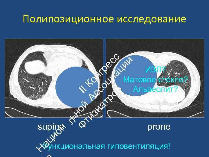 ьн Ф ой II ти А К зи с он ат со гр ро