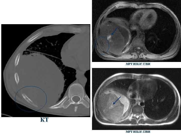 МРТ ИПSE T 1 ВИ КТ МРТ ИПSE T 2 ВИ 