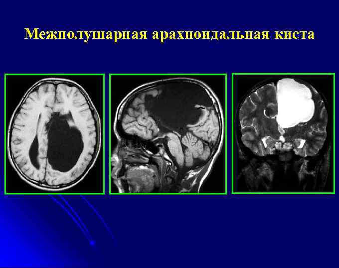 Компьютерная томография головного мозга где сделать