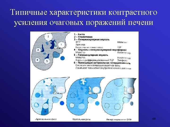 Типичные характеристики контрастного усиления очаговых поражений печени 48 