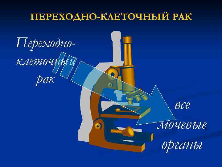 ПЕРЕХОДНО-КЛЕТОЧНЫЙ РАК Переходноклеточный рак все мочевые органы 